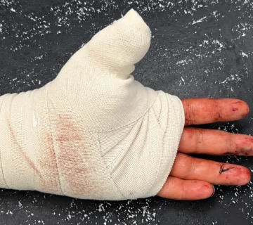 Bandaged Hand on Speckled Table result 360x320