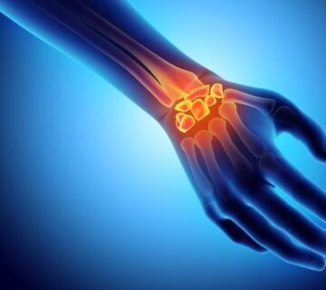 Carpel 360x320