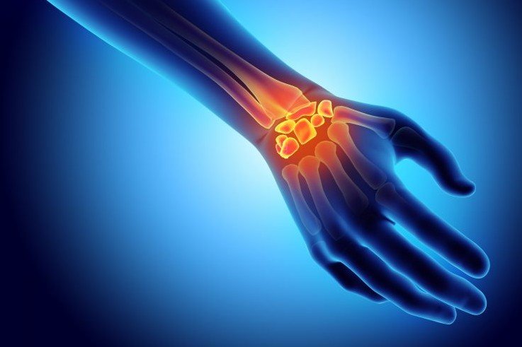 Carpel
