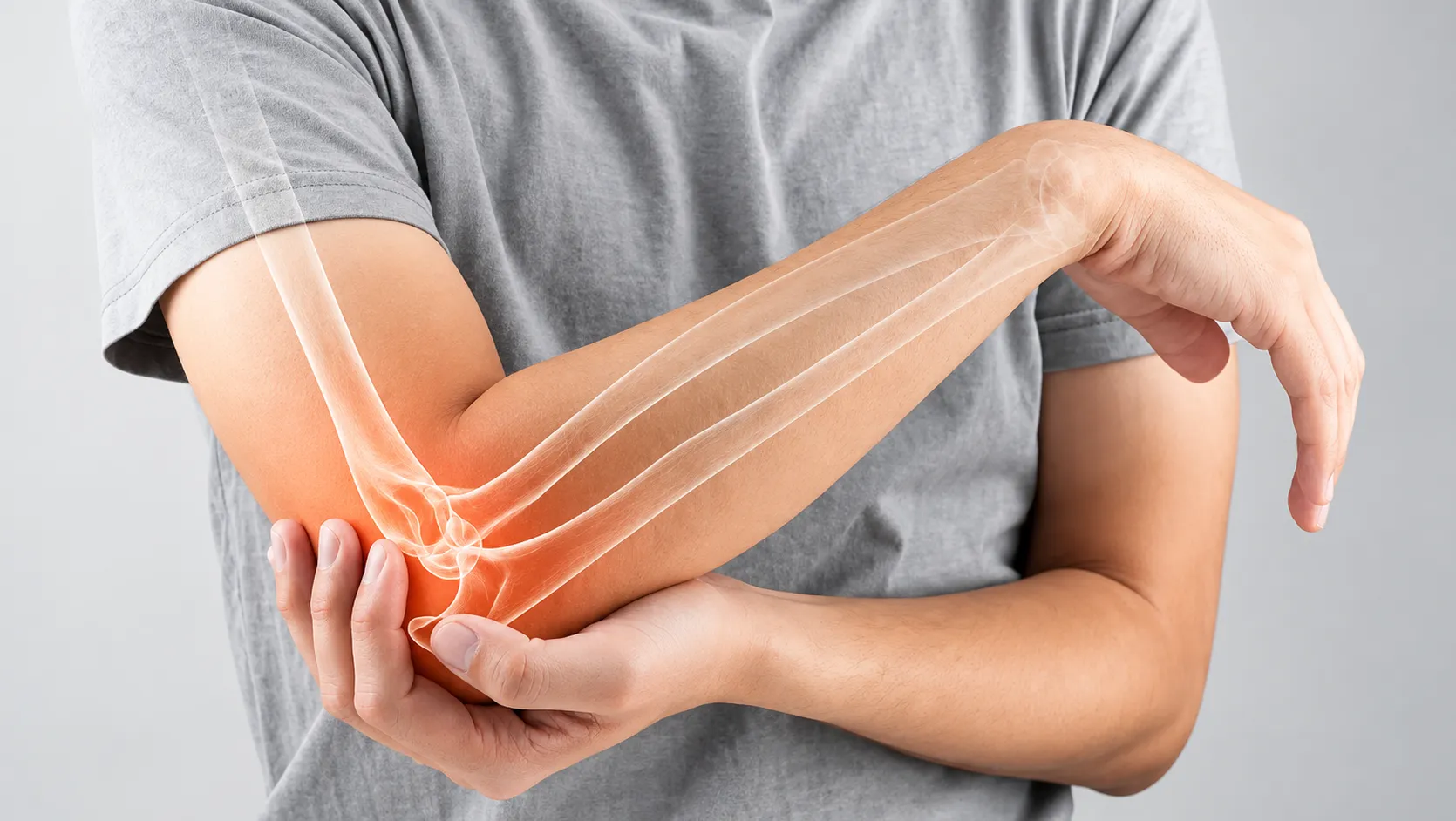 Elbow image 1670x942 result