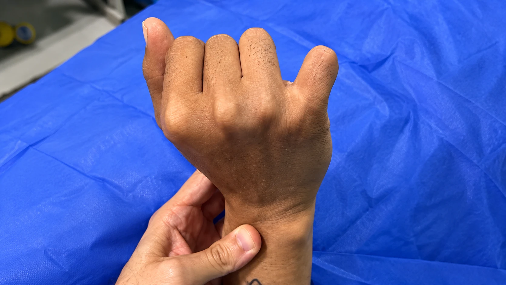 Clinical Hand and Wrist Examination result