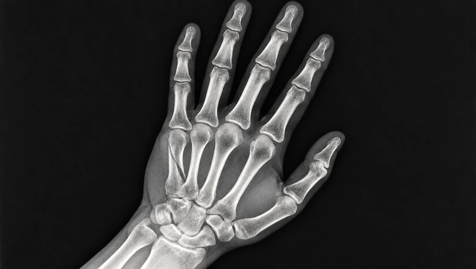Detailed Hand and Wrist X Ray result