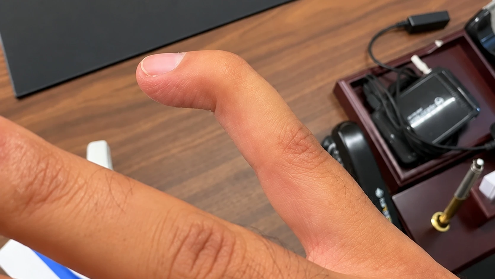 Bent finger 1670x942 result